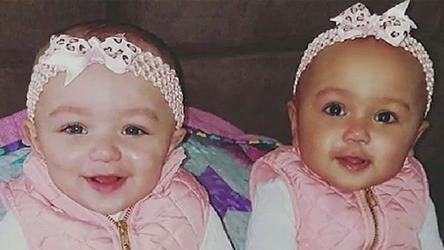 Twins born with different skin colors