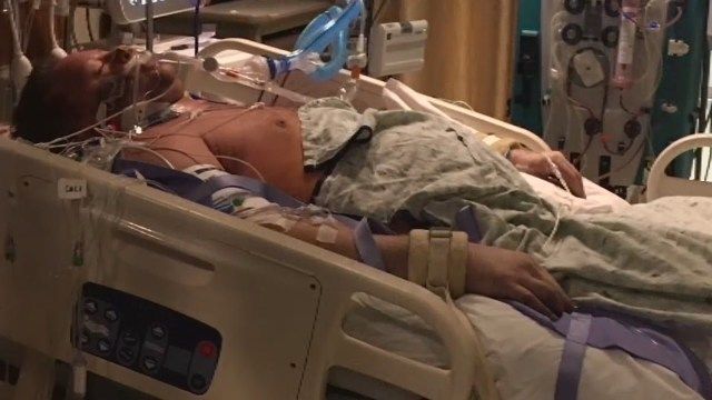 GRAPHIC: Strep throat leads to amputation of dad's hands, feet