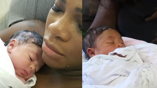 Image result for serena williams baby pics